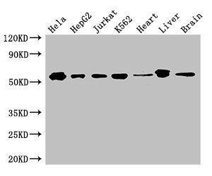 Western Blot Positive WB detected in: Hela whole cell lysate, HepG2 whole cell lysate, Jurkat whole cell lysate, K562 whole cell lysate, Mouse heart tissue, Mouse liver tissue, Mouse brain tissue All lanes: SMAD2 antibody at 3ug/ml Secondary Goat polyclonal to rabbit IgG at 1/50000 dilution Predicted band size: 53, 49 kDa Observed band size: 53 kDa