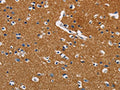 The image on the left is immunohistochemistry of paraffin-embedded Human brain tissue using CSB-PA155584(GPM6A Antibody) at dilution 1/40, on the right is treated with fusion protein. (Original magnification: ×200)