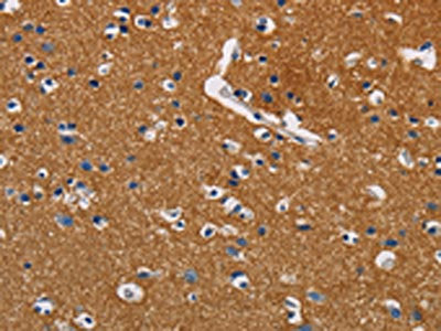 The image on the left is immunohistochemistry of paraffin-embedded Human brain tissue using CSB-PA155584(GPM6A Antibody) at dilution 1/40, on the right is treated with fusion protein. (Original magnification: ×200)