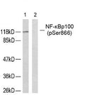 Western blot analysis of extracts from ovary cancer cells using NF-κ;B p100 (phospho-Ser866) antibody.