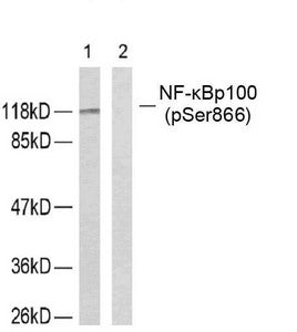Western blot analysis of extracts from ovary cancer cells using NF-κ;B p100 (phospho-Ser866) antibody.