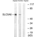 Western blot analysis of extracts from HepG2 cells and HUVEC cells, using SLC5A6 antibody.