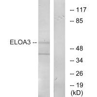 Western blot analysis of extracts from COLO cells, using ELOA3 antibody.