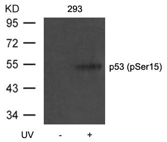 Western blot analysis of extracts from 293 cells untreated or treated with UV using p53(Phospho-Ser15) Antibody.