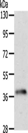 Gel: 10%SDS-PAGE, Lysate: 40 ug, Lane: Human fetal brain tissue, Primary antibody: CSB-PA157595(SIRT2 Antibody) at dilution 1/100, Secondary antibody: Goat anti rabbit IgG at 1/8000 dilution, Exposure time: 2 minutes