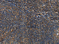The image on the left is immunohistochemistry of paraffin-embedded Human tonsil tissue using CSB-PA157805(IL17D Antibody) at dilution 1/50, on the right is treated with synthetic peptide. (Original magnification: ×200)