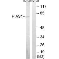 Western blot analysis of extracts from MDA-MB-435 cells, using PIAS1 antibody.