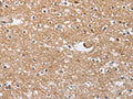 The image on the left is immunohistochemistry of paraffin-embedded Human brain tissue using CSB-PA158942(SOCS2 Antibody) at dilution 1/40, on the right is treated with fusion protein. (Original magnification: ×200)