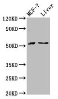 AKT2 Antibody – Figure 1 of 3