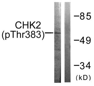 Western blot analysis of extracts from COS7 cells treated with UV using Chk2 (Phospho-Thr383) Antibody.The lane on the right is treated with the antigen-specific peptide.