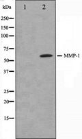 MMP1 Antibody
