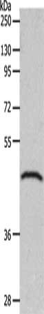 Gel: 10%SDS-PAGE, Lysate: 40 ug, Lane: Mouse brain tissue, Primary antibody: CSB-PA159987(GDF1 Antibody) at dilution 1/200, Secondary antibody: Goat anti rabbit IgG at 1/8000 dilution, Exposure time: 1 minute