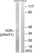 Western blot analysis of extracts from COLO cells, treated with Insulin (0.01U/ml, 15mins), using Vitamin D3 Receptor (Phospho-Ser51) antibody. The lane on the right is treated with the synthesized peptide.