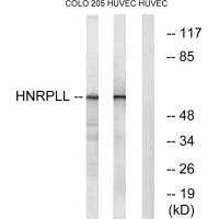 Western blot analysis of extracts from COLO cells and HUVEC cells, using HNRPLL antibody.
