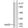 Western blot analysis of extracts from K562 cells, using NM23 antibody.