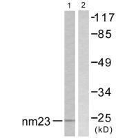 Western blot analysis of extracts from K562 cells, using NM23 antibody.