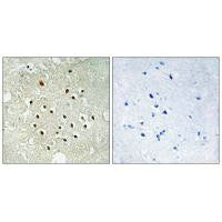 Immunohistochemistry analysis of paraffin-embedded human brain tissue using RPS19BP1 antibody.