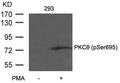 Western blot analysis of extracts from 293 cells untreated or treated with PMA using PKCth(Phospho-Ser695) Antibody.
