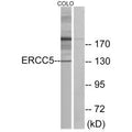 Western blot analysis of extracts from colo cells, using ERCC5 antibody.