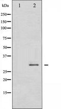Western blot analysis of SNAI1 expression in HT29 whole cell lysates,The lane on the left is treated with the antigen-specific peptide.
