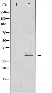 Western blot analysis of SNAI1 expression in HT29 whole cell lysates,The lane on the left is treated with the antigen-specific peptide.