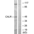 Western blot analysis of extracts from COS-7 cells, using CALR antibody.