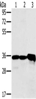 Gel: 8%SDS-PAGE, Lysate: 40 ug, Lane 1-3: Mouse kidney tissue, Jurkat cells, mouse heart tissue, Primary antibody: CSB-PA162245(NDUFA9 Antibody) at dilution 1/400, Secondary antibody: Goat anti rabbit IgG at 1/8000 dilution, Exposure time: 1 minute