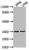 Western Blot
Positive WB detected in Recombinant protein
All lanes: WRKY47 antibody at 1:2000
Secondary
Goat polyclonal to rabbit IgG at 1/50000 dilution
Predicted band size: 35.7 kDa
Observed band size: 35 kDa