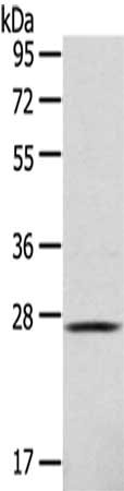 Gel: 10%SDS-PAGE,Lysate: 40 ug,,Primary antibody: CSB-PA162407(CLEC4D Antibody) at dilution 1/123 dilution,Secondary antibody: Goat anti rabbit IgG at 1/8000 dilution,Exposure time: 1 minute