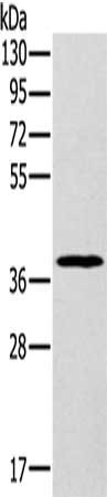 Gel: 8%SDS-PAGE, Lysate: 60 ug, Lane: Hela cells, Primary antibody: CSB-PA162567(MDH1 Antibody) at dilution 1/200, Secondary antibody: Goat anti rabbit IgG at 1/8000 dilution, Exposure time: 1 minute