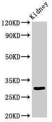 Western Blot
Positive WB detected in: Rat kidney tissue
All lanes: IGFBP7 antibody at 3.4ug/ml
Secondary
Goat polyclonal to rabbit IgG at 1/50000 dilution
Predicted band size: 30, 29 kDa
Observed band size: 30 kDa