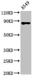 Western Blot
Positive WB detected in: A549 whole cell lysate
All lanes: IKBKB antibody at 3.4µg/ml
Secondary
Goat polyclonal to rabbit IgG at 1/50000 dilution
Predicted band size: 87, 86, 30, 80 kDa
Observed band size: 87 kDa