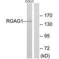 Western blot analysis of extracts from COLO cells, using RGAG1 antibody.