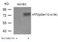 Western blot analysis of extracts from Huvec cells untreated or treated with Anisomycin using ATF2(Phospho-Ser112 or 94) Antibody.