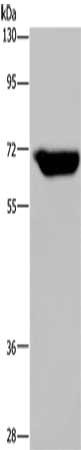 Gel: 8%SDS-PAGE, Lysate: 40 ug, Lane: Human breast infiltrative duct tissue, Primary antibody: CSB-PA163798(JMJD6 Antibody) at dilution 1/425, Secondary antibody: Goat anti rabbit IgG at 1/8000 dilution, Exposure time: 30 seconds