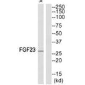 Western blot analysis of extracts from JK cells, using FGF23 antiobdy.