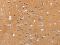The image on the left is immunohistochemistry of paraffin-embedded Human brain tissue using CSB-PA164401(JAK2 Antibody) at dilution 1/35, on the right is treated with synthetic peptide. (Original magnification: ×200)