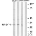 Western blot analysis of extracts from COLO cells, HeLa cells and HUVEC cells, using RPS4Y1 antibody.