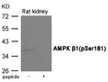 Western blot analysis of extracts from Rat kindey using AMPK β1(Phospho-Ser181) Antibody.The lane on the right is treated with the antigen-specific peptide.