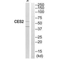 Western blot analysis of extracts from Jurkat cells, using CES2 antibody.