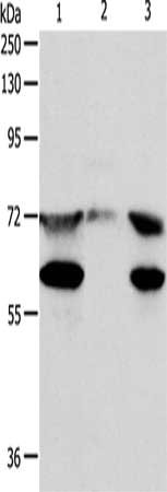 Gel: 8%SDS-PAGE, Lysate: 40 ug, Lane 1-3: Hela cells, mouse testis tissue, Jurkat cells, Primary antibody: CSB-PA167401(SPDL1 Antibody) at dilution 1/400, Secondary antibody: Goat anti rabbit IgG at 1/8000 dilution, Exposure time: 30 seconds