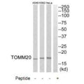 Western blot analysis of extracts from HeLa cells, K562 cells and A549 cells, using TOMM20 antibody.