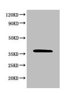 Western Blot
Positive WB detected in: 293T whole cell lysate
All lanes: MAPK8 antibody at 6µg/ml
Secondary
Goat polyclonal to rabbit IgG at 1/50000 dilution
Predicted band size: 49, 45, 36 KDa
Observed band size: 36 KDa