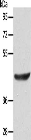 Gel: 10%SDS-PAGE, Lysate: 40 ug, Lane: Jurkat cells, Primary antibody: CSB-PA167754(ACTRT1 Antibody) at dilution 1/125, Secondary antibody: Goat anti rabbit IgG at 1/8000 dilution, Exposure time: 10 seconds