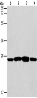Gel: 12%SDS-PAGE, Lysate: 40 ug, Lane 1-4: Jurkat cells, A431 cells, A549 cells, A375 cells, Primary antibody: CSB-PA168017(CASP14 Antibody) at dilution 1/350, Secondary antibody: Goat anti rabbit IgG at 1/8000 dilution, Exposure time: 10 seconds