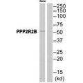 Western blot analysis of extracts from HeLa cells, using PPP2R2B antibody.