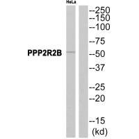 Western blot analysis of extracts from HeLa cells, using PPP2R2B antibody.