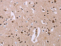 The image on the left is immunohistochemistry of paraffin-embedded Human brain tissue using CSB-PA168510(ANLN Antibody) at dilution 1/20, on the right is treated with fusion protein. (Original magnification: ×200)