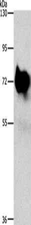 Gel: 8%SDS-PAGE, Lysate: 30 ug, Lane: Mouse brain tissue, Primary antibody: CSB-PA168554(SYN1 Antibody) at dilution 1/750, Secondary antibody: Goat anti rabbit IgG at 1/8000 dilution, Exposure time: 2 seconds