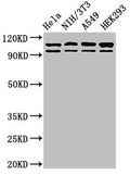 Western Blot
Positive WB detected in: Hela whole cell lysate, NIH/3T3 whole cell lysate, A549 whole cell lysate, HEK293 whole cell lysate
All lanes: MSH2 antibody at 2ug/ml
Secondary
Goat polyclonal to rabbit IgG at 1/50000 dilution
Predicted band size: 105, 98 kDa
Observed band size: 105, 98 kDa